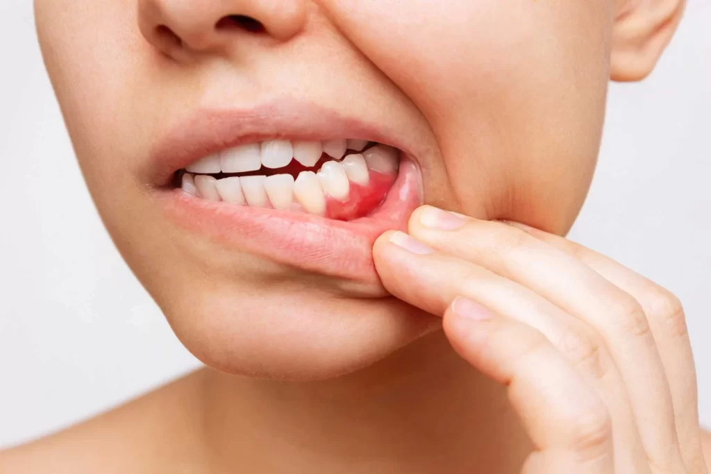 Diş eti sağlığı, genel ağız sağlığının temel taşlarından biridir ve genellikle göz ardı edilen bir konudur. Sağlıklı diş etleri, diş kaybının önlenmesinde ve ağız içi hastalıkların tedavisinde kritik bir role sahiptir.